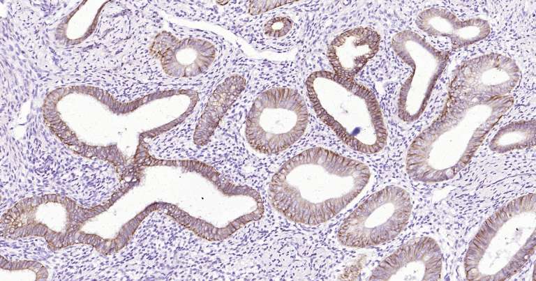人细胞角蛋白18即用型免疫组化试剂盒-IHC0249H
